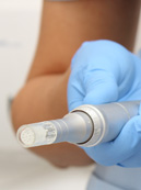 Dermapen