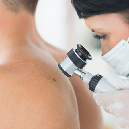 Konsultacja dermatologiczna